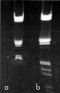 superagarose